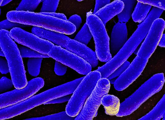 Το E. coli προκαλεί συχνότερα την ανάπτυξη κυστίτιδας στις γυναίκες